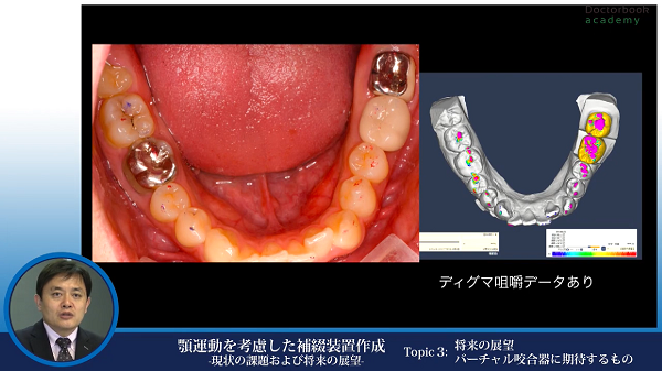 Occlusionの真髄～色々な咬合と機能～ | Doctorbook academy